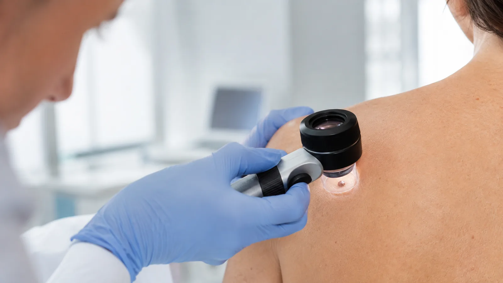 Médico dermatólogo evaluando la piel de una paciente